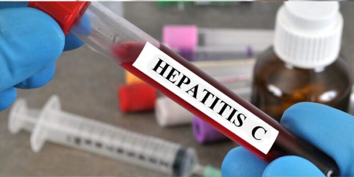 Pakistan tops world in hepatitis C infections